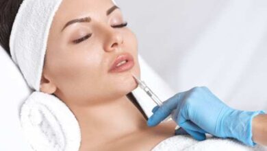 Lip Fillers